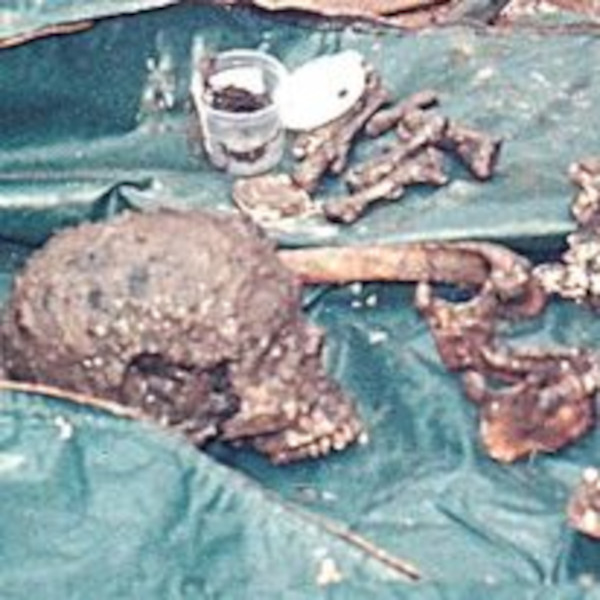 Chakradhari's skull